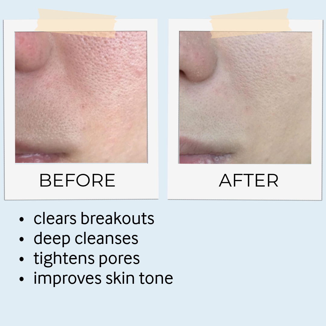 Rhassoul Mask & Scrub