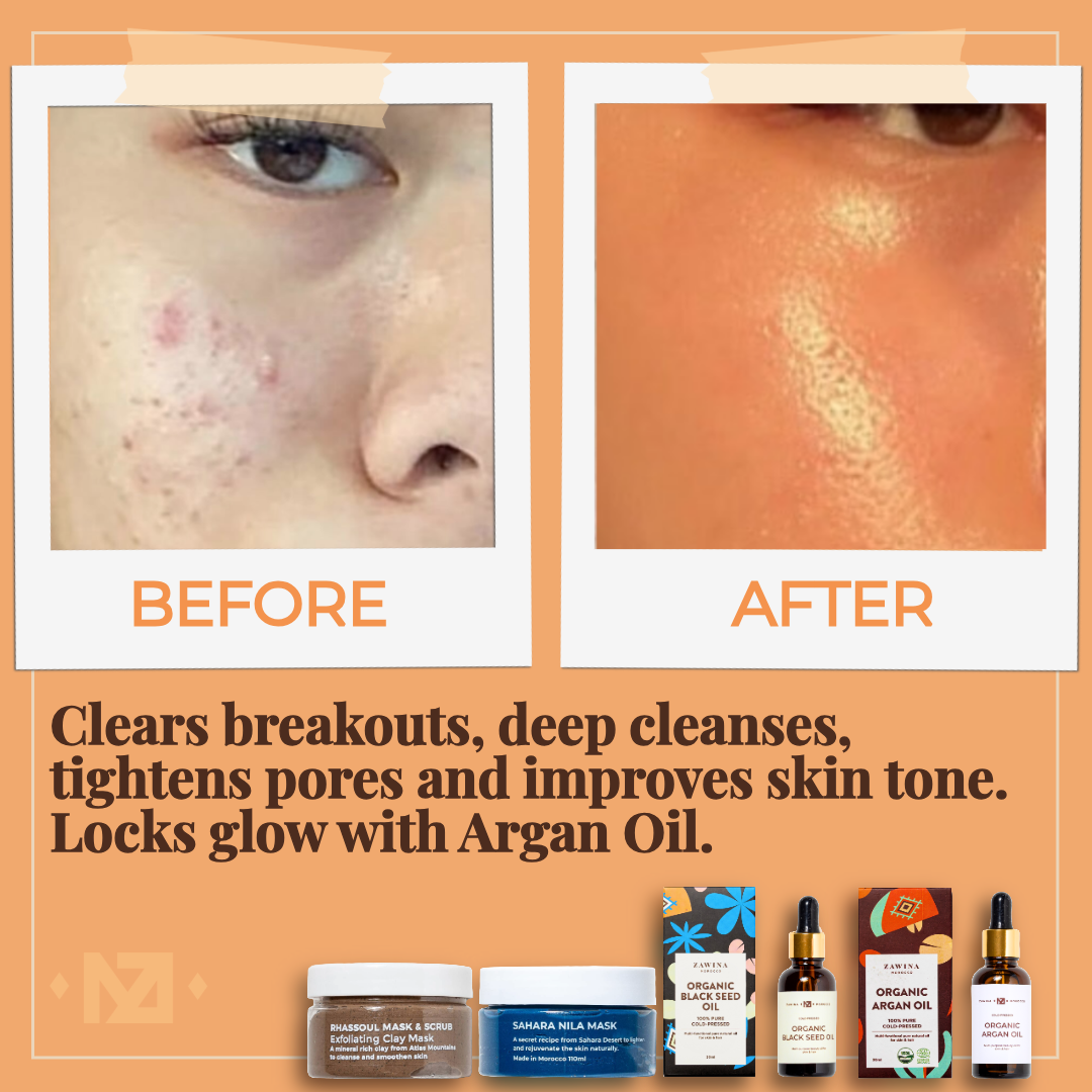 RHASSOUL MASK & SCRUB