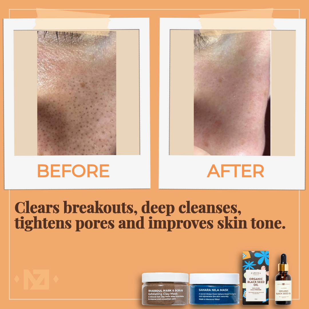 RHASSOUL MASK & SCRUB