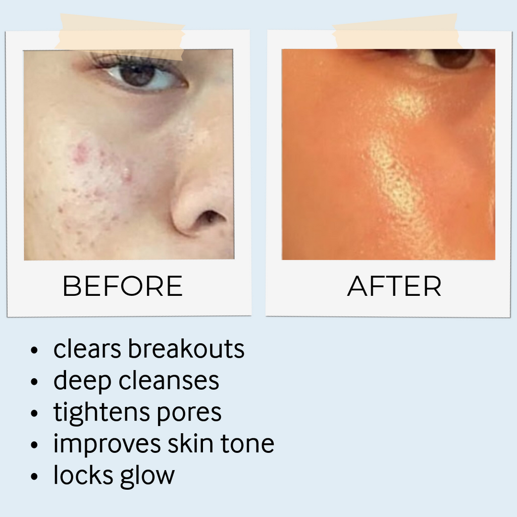 RHASSOUL MASK & SCRUB