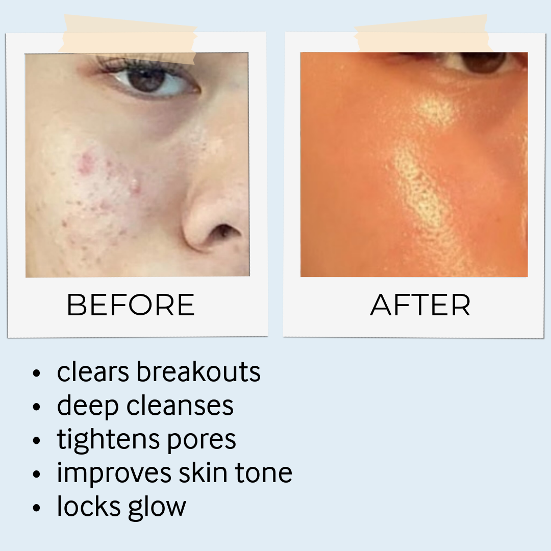 RHASSOUL MASK & SCRUB
