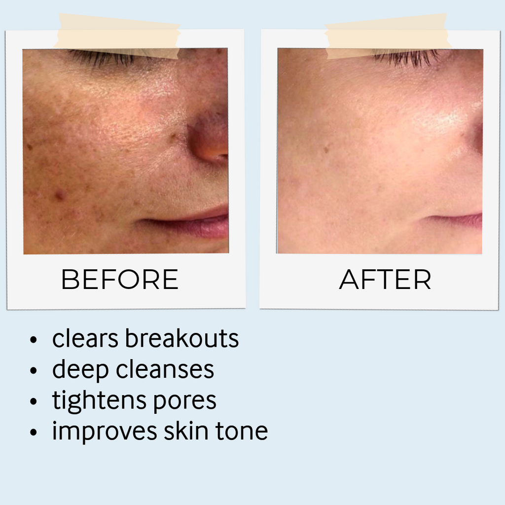 RHASSOUL MASK & SCRUB