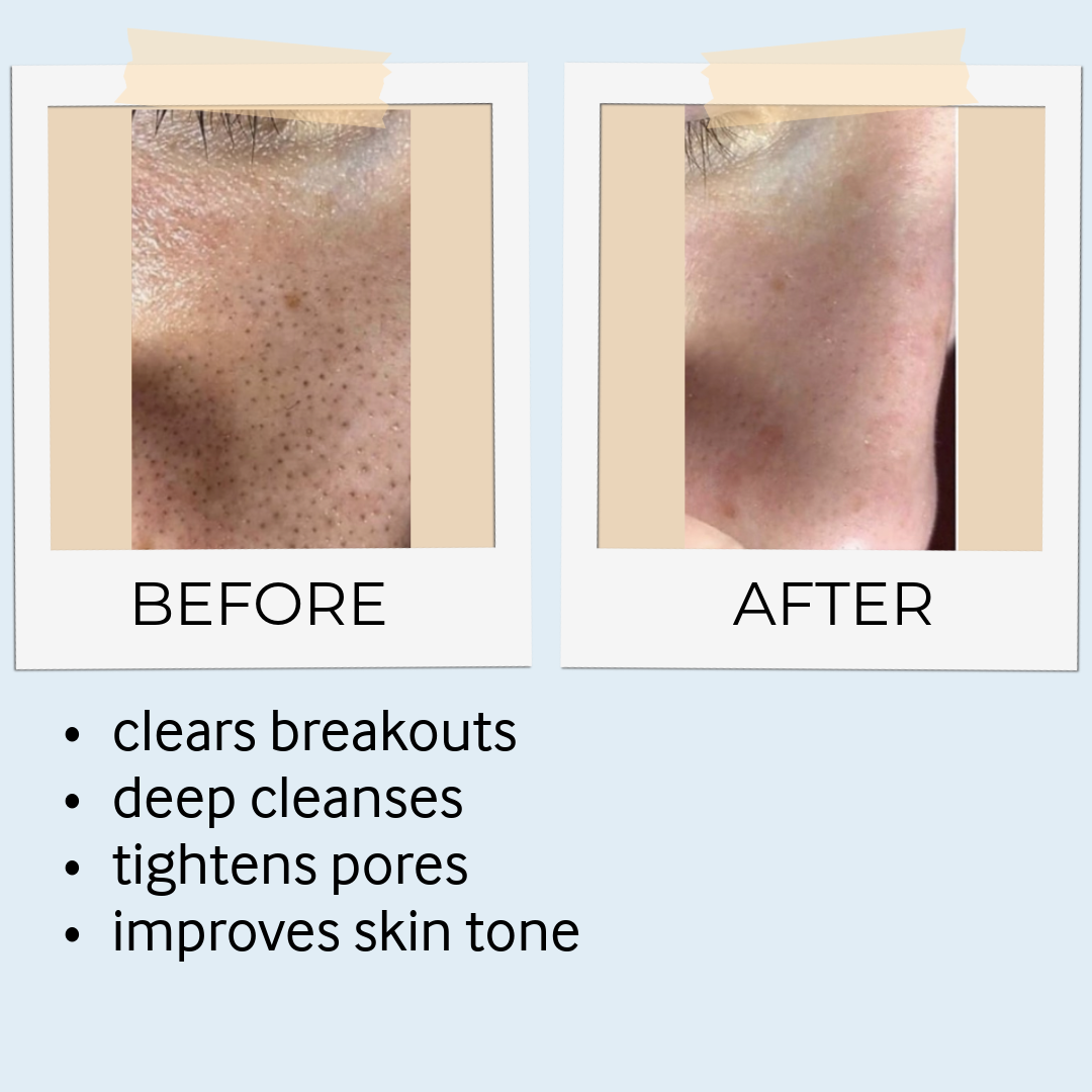 RHASSOUL MASK & SCRUB