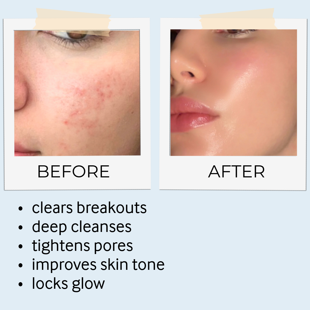RHASSOUL MASK & SCRUB