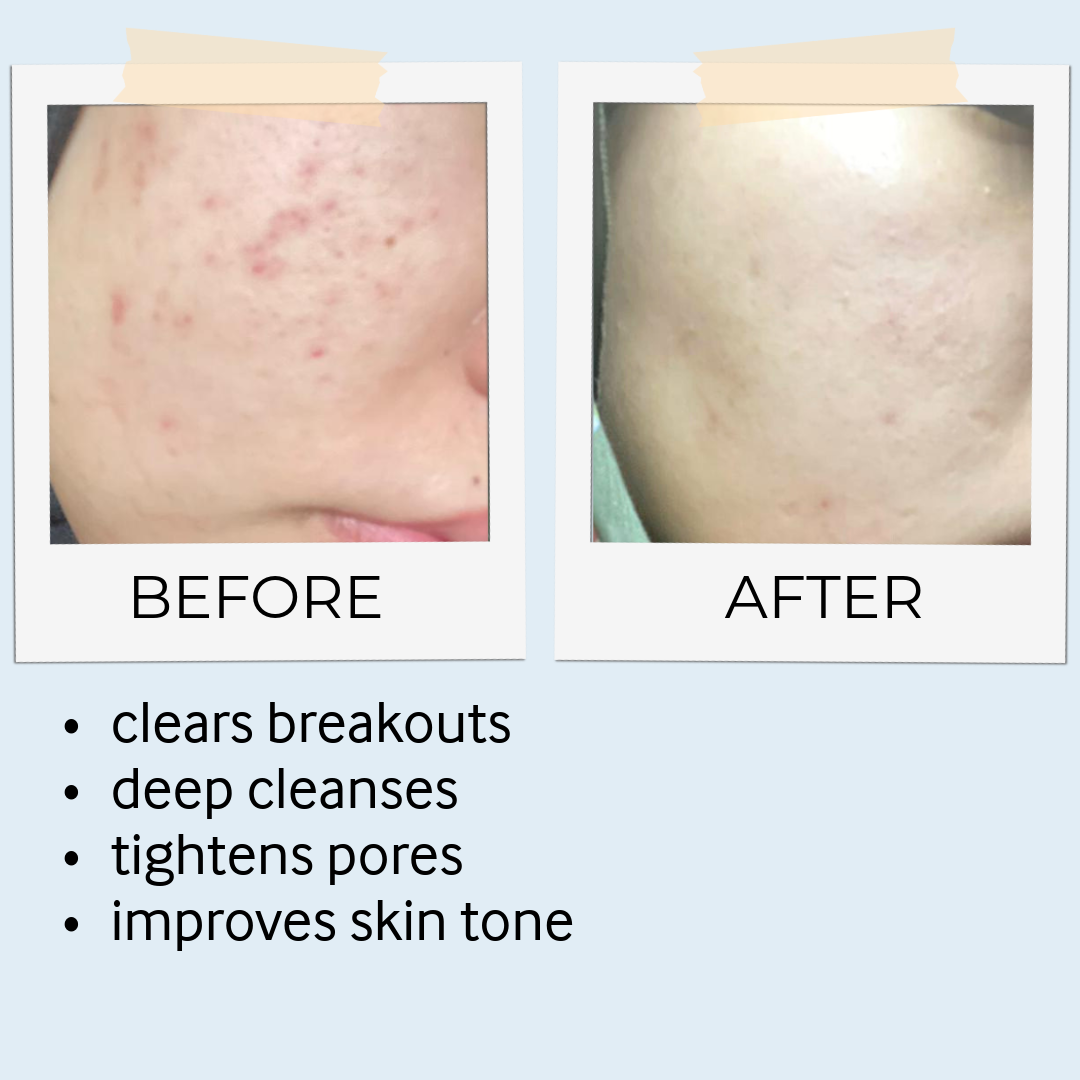 RHASSOUL MASK & SCRUB