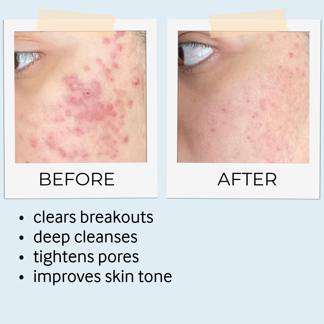 RHASSOUL MASK & SCRUB